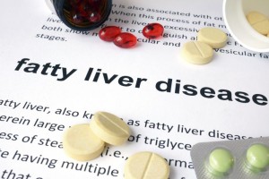Liver Disease fatty liver