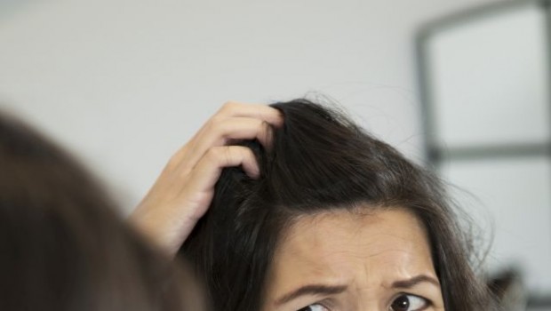 How to Deal with an Itchy Scalp Using Natural Remedies